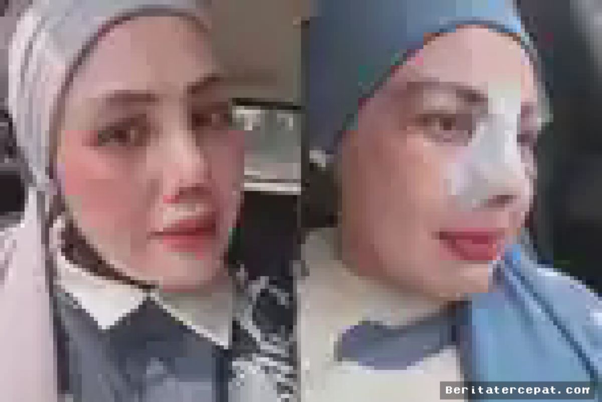 Elly Sugigi Klaim Wajah Barunya Mirip Irish Bella Usai Operasi Plastik